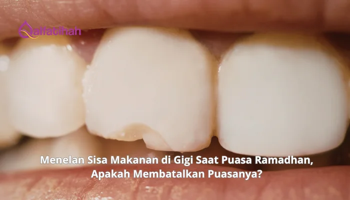 Menelan Sisa Makanan di Gigi Saat Puasa Ramadhan, Apakah Membatalkan Puasanya?